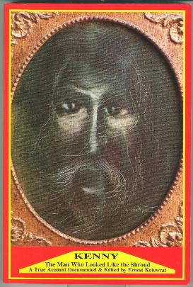 Ken Klinkert - The Man Who Looked Like the Shroud